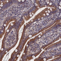 Invitrogen SPATA13 Polyclonal Antibody 100 &mu;L; Unconjugated:Antibodies,