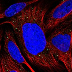 Invitrogen TMEM39B Polyclonal Antibody 100 &mu;L | Buy Online | Invitrogen&trade; | Fisher Scientific