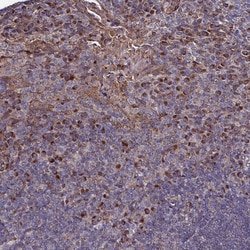 Invitrogen SEC24C Polyclonal Antibody 100 &mu;L | Buy Online | Invitrogen&trade; | Fisher Scientific