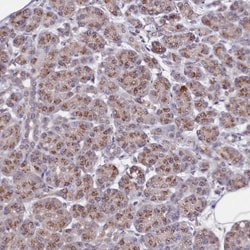 Invitrogen SEC24C Polyclonal Antibody 100 &mu;L | Buy Online | Invitrogen&trade; | Fisher Scientific