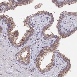 Invitrogen SEC24C Polyclonal Antibody 100 &mu;L | Buy Online | Invitrogen&trade; | Fisher Scientific