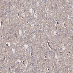 Invitrogen AOX1 Polyclonal Antibody 100 &mu;L | Buy Online | Invitrogen&trade; | Fisher Scientific