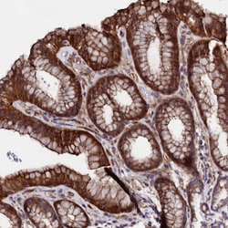 Invitrogen STAMBPL1 Polyclonal Antibody 100 &mu;L; Unconjugated:Antibodies,