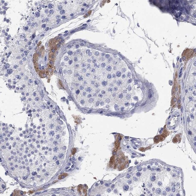 Invitrogen AOX1 Polyclonal Antibody 100 μL; Unconjugated
