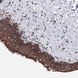 Invitrogen ZDHHC18 Polyclonal Antibody 100 &mu;L; Unconjugated:Antibodies,