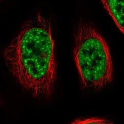 Invitrogen RBM26 Polyclonal Antibody 100 &mu;L; Unconjugated:Antibodies,