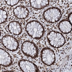 Invitrogen RBM26 Polyclonal Antibody 100 &mu;L; Unconjugated:Antibodies,
