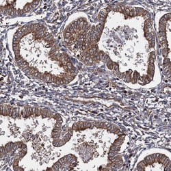 Invitrogen ATP8B4 Polyclonal Antibody 100 &mu;L; Unconjugated:Antibodies,