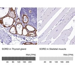 Invitrogen Sorbitol Dehydrogenase Polyclonal Antibody 100 &mu;L; Unconjugated:Antibodies,