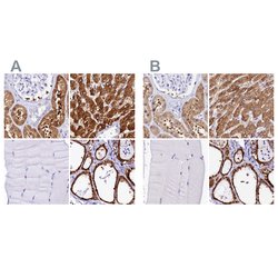 Invitrogen Sorbitol Dehydrogenase Polyclonal Antibody 100 &mu;L; Unconjugated:Antibodies,