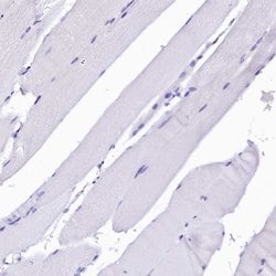 Invitrogen Sorbitol Dehydrogenase Polyclonal Antibody 100 &mu;L; Unconjugated:Antibodies,