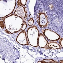 Invitrogen Sorbitol Dehydrogenase Polyclonal Antibody 100 &mu;L; Unconjugated:Antibodies,