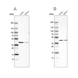 Invitrogen Sorbitol Dehydrogenase Polyclonal Antibody 100 &mu;L; Unconjugated:Antibodies,