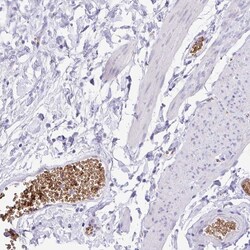 Invitrogen EPB42 Polyclonal Antibody 100 &mu;L; Unconjugated:Antibodies,