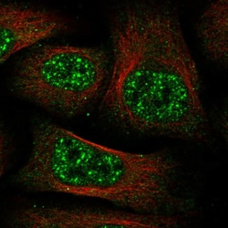 Invitrogen C11orf49 Polyclonal Antibody 100 &mu;L; Unconjugated:Antibodies,