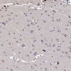Invitrogen C11orf49 Polyclonal Antibody 100 &mu;L; Unconjugated:Antibodies,