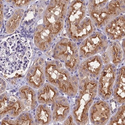Invitrogen C11orf49 Polyclonal Antibody 100 &mu;L; Unconjugated:Antibodies,