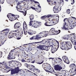 Invitrogen C11orf49 Polyclonal Antibody 100 &mu;L; Unconjugated:Antibodies,