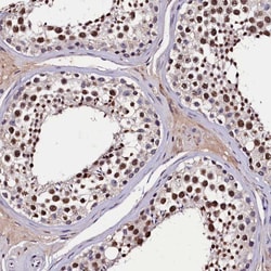 Invitrogen C11orf49 Polyclonal Antibody 100 &mu;L; Unconjugated:Antibodies,