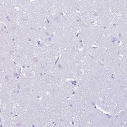 Invitrogen PLBD1 Polyclonal Antibody 100 &mu;L; Unconjugated:Antibodies,