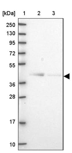 Invitrogen OGFOD2 Polyclonal Antibody 100 &mu;L | Buy Online | Invitrogen&trade; | Fisher Scientific