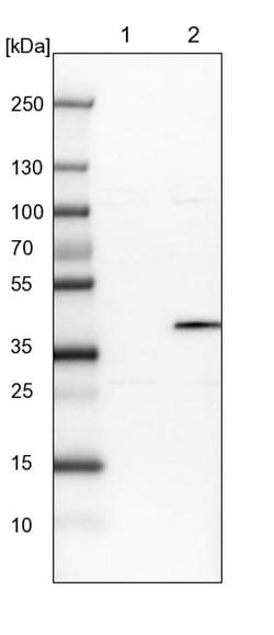 Invitrogen OGFOD2 Polyclonal Antibody 100 &mu;L | Buy Online | Invitrogen&trade; | Fisher Scientific