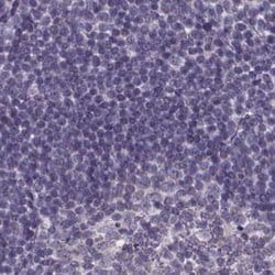 SPEF2 Polyclonal Antibody:Antibodies, Polyclonal