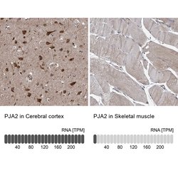 Invitrogen PJA2 Polyclonal Antibody 100 &mu;L | Buy Online | Invitrogen&trade; | Fisher Scientific