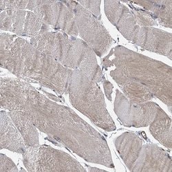 Invitrogen PJA2 Polyclonal Antibody 100 &mu;L | Buy Online | Invitrogen&trade; | Fisher Scientific