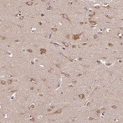 Invitrogen BRAP Polyclonal Antibody 100 &mu;L; Unconjugated:Antibodies,