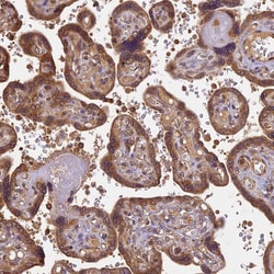 Invitrogen BRAP Polyclonal Antibody 100 &mu;L; Unconjugated:Antibodies,