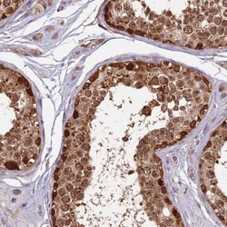 Invitrogen RAPGEF3 Polyclonal Antibody 100 &mu;L; Unconjugated:Antibodies,