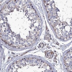 Invitrogen TTC23 Polyclonal Antibody 100 &mu;L; Unconjugated:Antibodies,