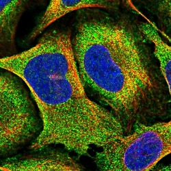 Invitrogen PIGN Polyclonal Antibody 100 &mu;L; Unconjugated:Antibodies,