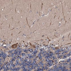 Invitrogen CKAP5 Polyclonal Antibody 100 &mu;L; Unconjugated:Antibodies,