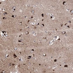 Invitrogen CKAP5 Polyclonal Antibody 100 &mu;L; Unconjugated:Antibodies,