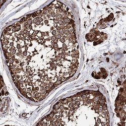 Invitrogen CKAP5 Polyclonal Antibody 100 &mu;L; Unconjugated:Antibodies,
