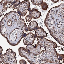 Invitrogen CKAP5 Polyclonal Antibody 100 &mu;L; Unconjugated:Antibodies,