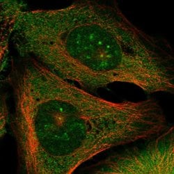 Invitrogen CKAP5 Polyclonal Antibody 100 &mu;L; Unconjugated:Antibodies,