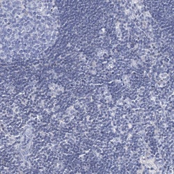Invitrogen TOX3 Polyclonal Antibody 100 &mu;L; Unconjugated:Antibodies,