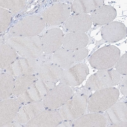Invitrogen TOX3 Polyclonal Antibody 100 &mu;L; Unconjugated:Antibodies,