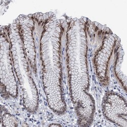 Invitrogen TOX3 Polyclonal Antibody 100 &mu;L; Unconjugated:Antibodies,