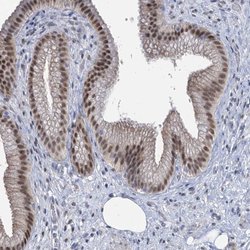 Invitrogen TOX3 Polyclonal Antibody 100 &mu;L; Unconjugated:Antibodies,