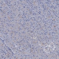 Invitrogen TOX3 Polyclonal Antibody 100 &mu;L; Unconjugated:Antibodies,
