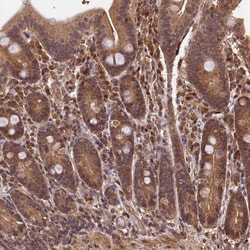 Invitrogen CEP57L1 Polyclonal Antibody 100 &mu;L; Unconjugated:Antibodies,