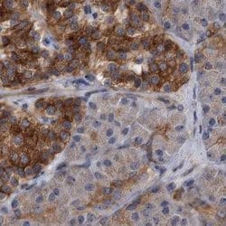 Invitrogen NBEA Polyclonal Antibody 100 &mu;L; Unconjugated:Antibodies,