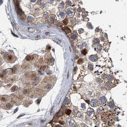 Invitrogen NBEA Polyclonal Antibody 100 &mu;L; Unconjugated:Antibodies,