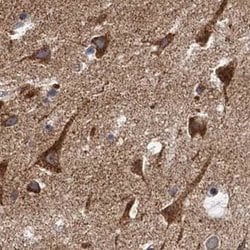 Invitrogen NBEA Polyclonal Antibody 100 &mu;L; Unconjugated:Antibodies,
