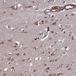 Invitrogen FCP1 Polyclonal Antibody 100 &mu;L; Unconjugated:Antibodies,