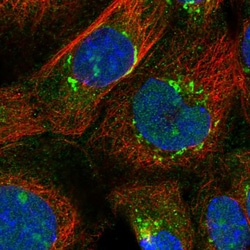 beta L Crystallin Polyclonal Antibody:Antibodies, Polyclonal